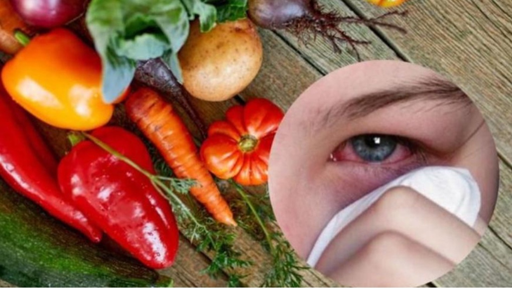 Những thực phẩm mà người đau mắt đỏ nên và không nên ăn